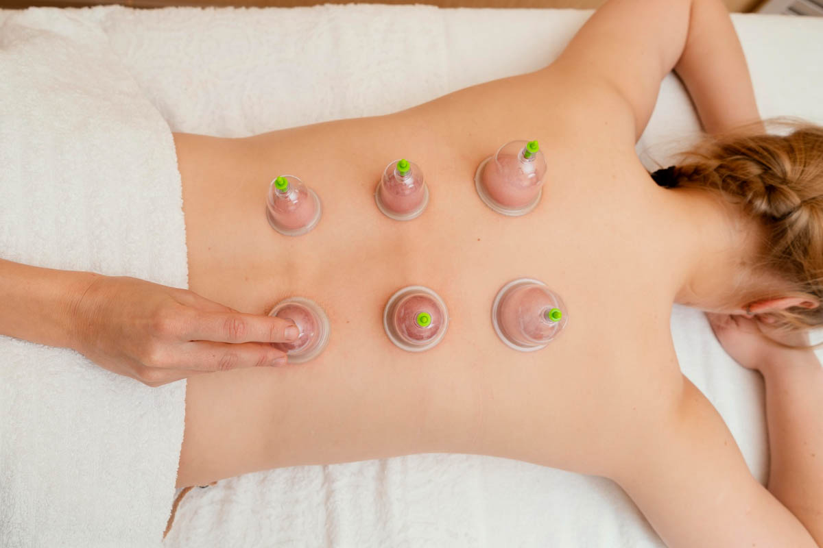 Who Shouldn’t Get Cupping?