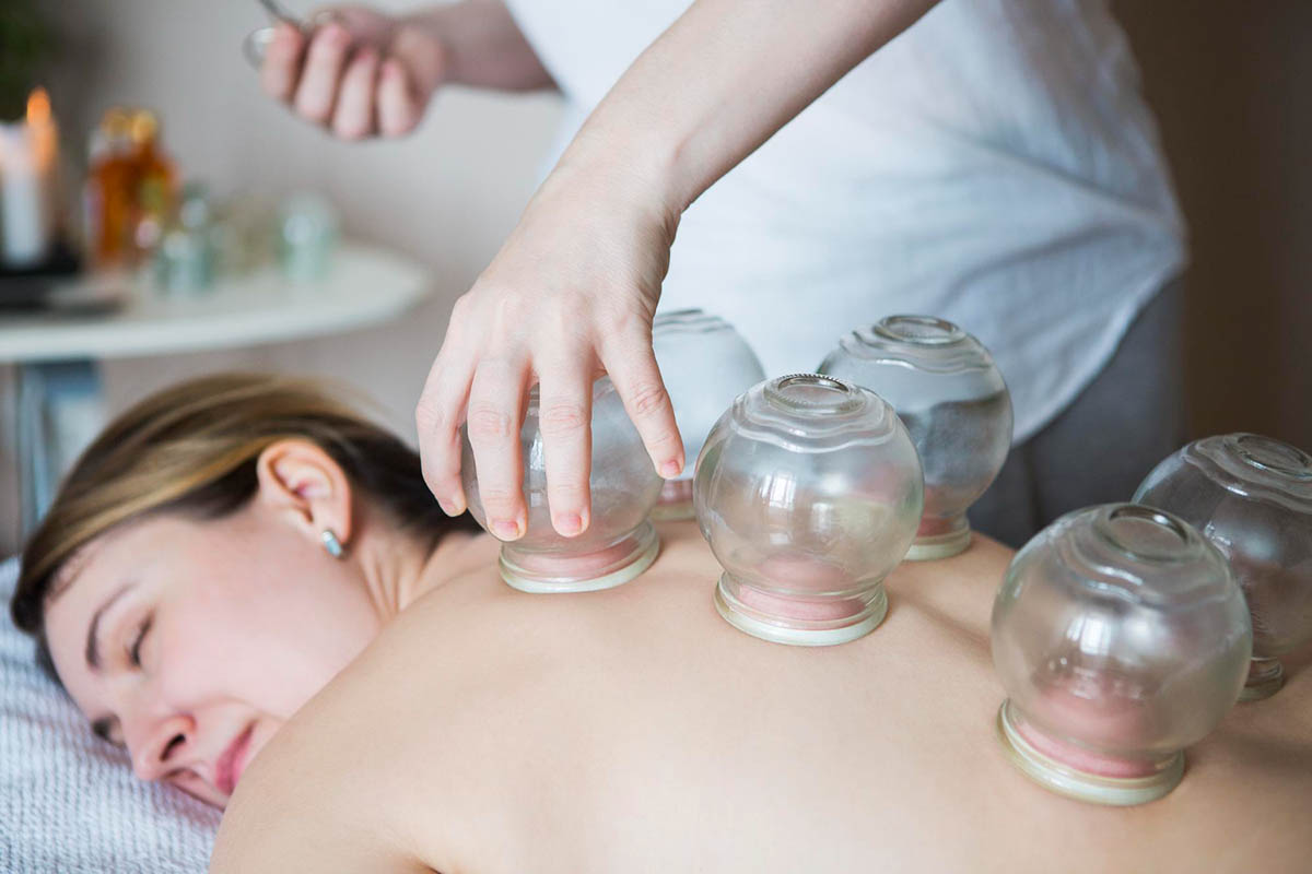 Dry Cupping Therapy